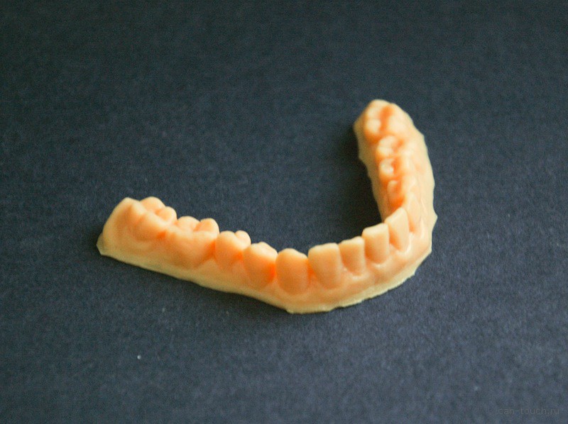3D-печать, стоматология