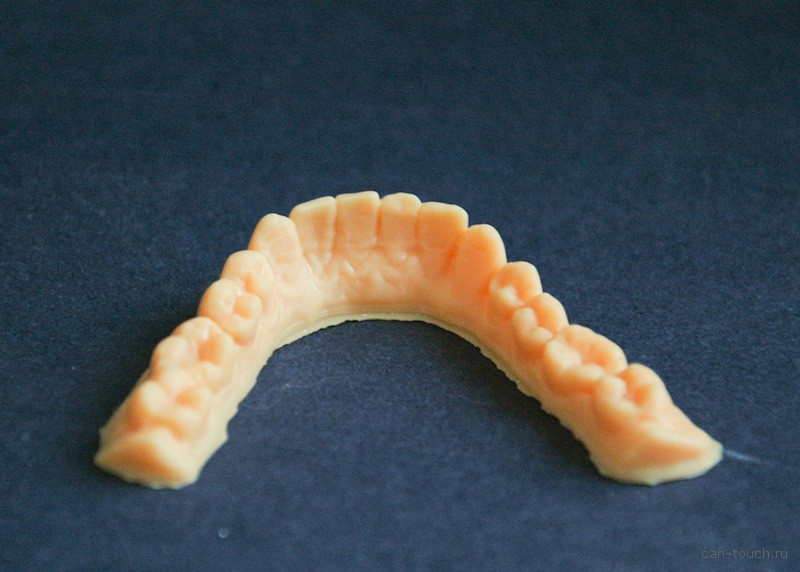 3D-печать, стоматология