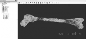 CAD-моделей по данным КТ и МРТ, 3D-печать