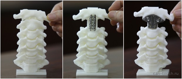 CAD-моделей по данным КТ и МРТ, 3D-печать 