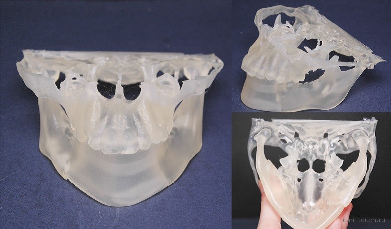 3D-печать, медицина