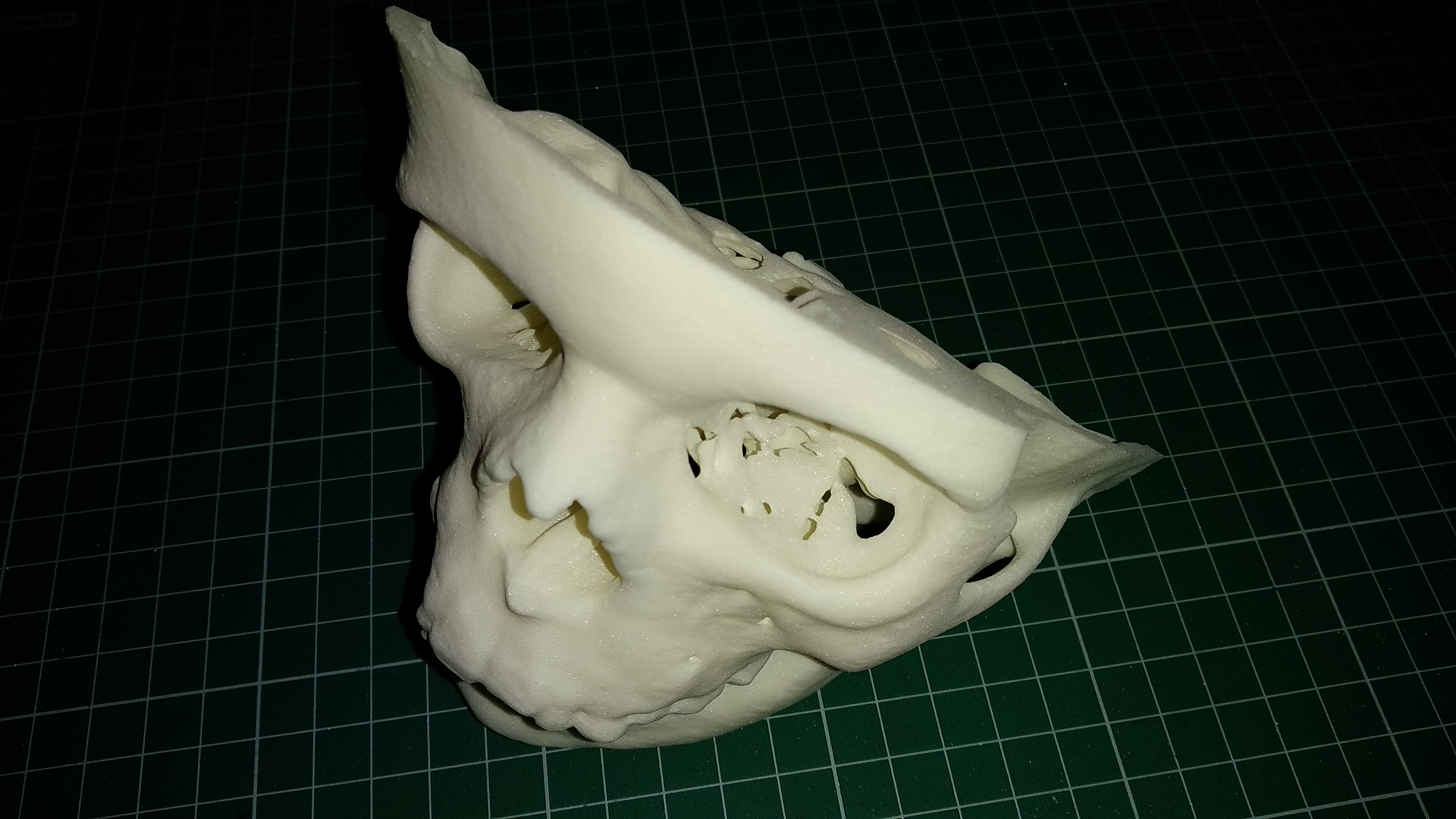 3D-печать по снимкам КТ